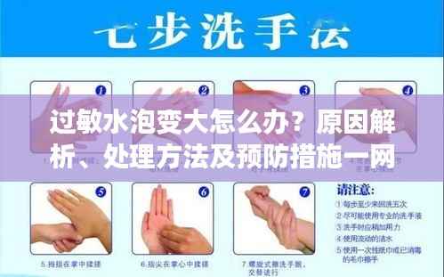过敏水泡变大怎么办?原因解析、处理方法及预防措施一网打尽!